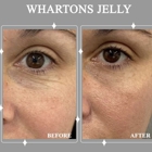 Body Sculpt Skin Laser