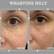 Body Sculpt Skin Laser