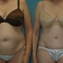 Lowe Plastic Surgery - Day Spas