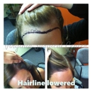 Virginia Surgical Center - Hair Replacement