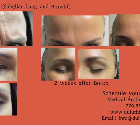 Medical Aesthetics of Duluth - Duluth, GA