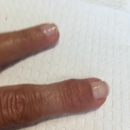 Chamoy, Lewis, MD - Physicians & Surgeons, Hand Surgery