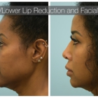 Lam Facial Plastics