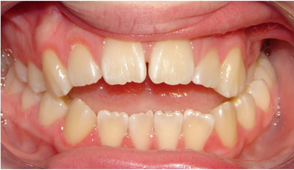 Active Orthodontics - Bundaberg South, QLD