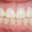 Sheen, Geoffrey DDS MS - Implant Dentistry