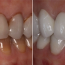 Derek Faktor DMD - Implant Dentistry