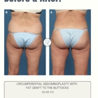 Plastic Surgery Associates