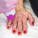 LaserAway Midland - Hair Removal