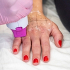 LaserAway Paramus