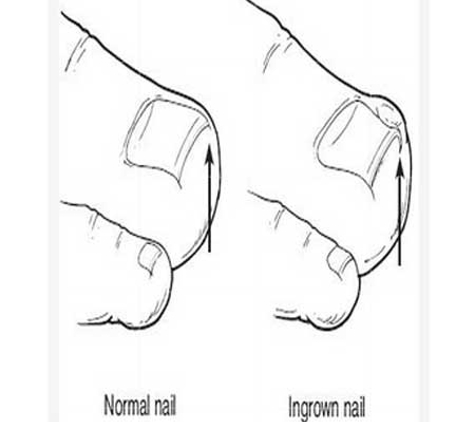 Silver Podiatry - Inglewood, WA