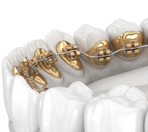 Heatherton Dental - Dandenong North, VIC