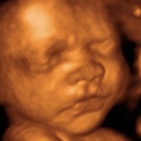 Bond Before Birth 3D/4D Ultrasound