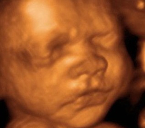 Bond Before Birth 3D/4D Ultrasound - Feasterville Trevose, PA