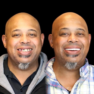 Smile Now Denver Dentures and Implants - Westminster, CO