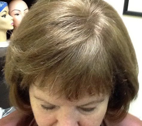 Becky Hair Replacement Specialist - Port Richey, FL