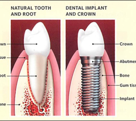 Dental Implant Center of the Carolinas - Greensboro, NC