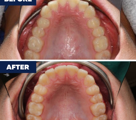 Orthodontics of Anaheim - Anaheim, CA