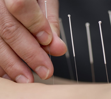 Blooming Lotus Acupuncture - Avondale, AZ