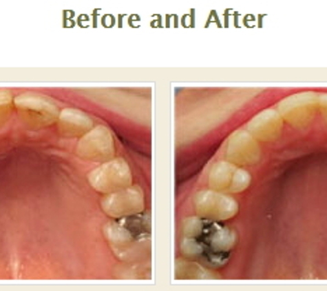 StarBrite Dental - Dublin - Dublin, CA