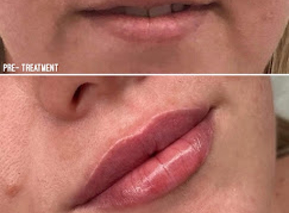BeautyFULL Cosmetic Medical Clinic Kingscliff - Kingscliff, NSW
