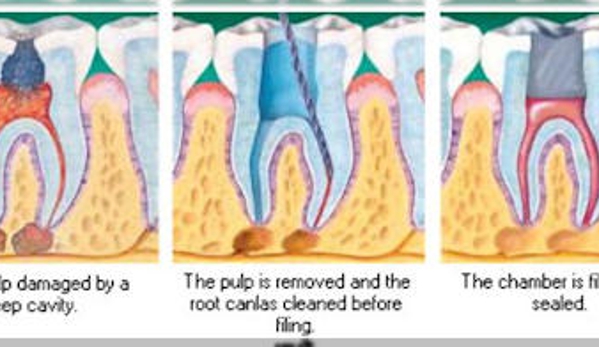 Drakeshire Dental - Farmington, MI. Endodontics Farmington Hills, MI