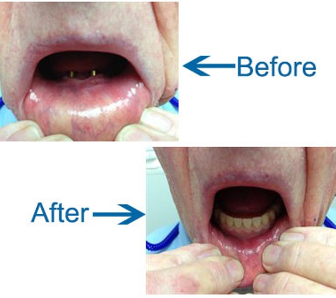 Cronulla Denture Care