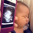 Mobile Gender Reveals - Medical Imaging Services