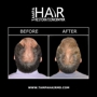 Tampa Hair Restoration Center