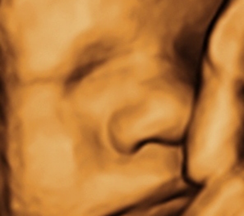 TLC Imaging 3D/4D Ultrasounds - Reynoldsburg, OH