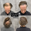 Smp Ink Cda - Hair Replacement