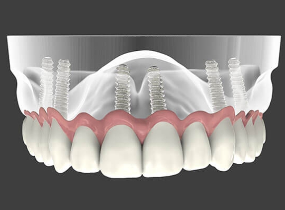 Endodontic Center - Stoughton, MA