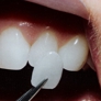 Photo #01