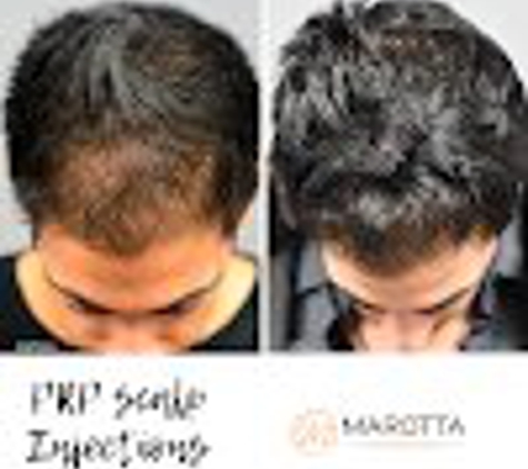 Marotta Hair Restoration - Smithtown, NY