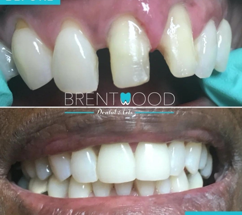 Brentwood Dental Care - Los Angeles, CA