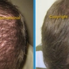 Hair Growth Clinic of CT gallery