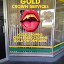 Gold Crown Services - Dentists