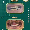 Vibe Dental Huntsville - Implant Dentistry