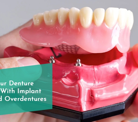 Abstract Arch Denture Clinic - Ringwood, VIC. Start Your Denture Journey With Implant Retained Overdentures