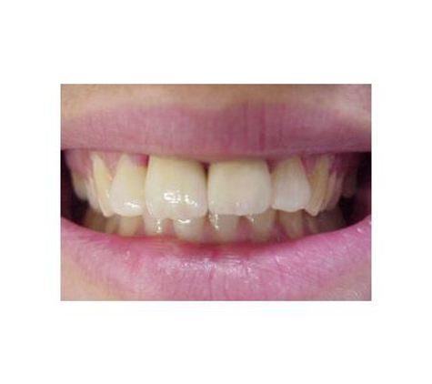 Aesthetic Prosthetics Pty Ltd - Wallsend, NSW
