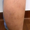 Shapiro Vein Center gallery