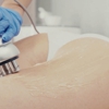 Electrolysis & Skin Care By Marina gallery