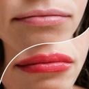EyEnvy Beauty Studio - Hair Removal