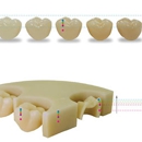 Backer Dental Laboratory - Implant Dentistry