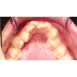 Active Orthodontics - Bundaberg South, QLD