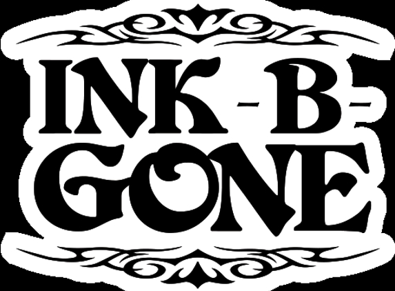 Ink-B-Gone Precision Laser Tattoo Removal - Denver, CO