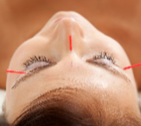 Holistic Acupuncture & Physical Therapy Center - Gaithersburg, MD