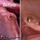 Dr. Mark A. Cruz - Dental Clinics