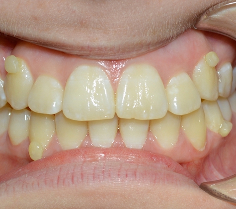 Wholistic Dentistry - Queanbeyan, NSW. After