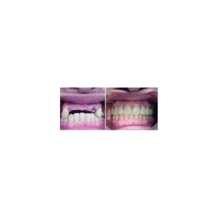 Affordable Denture Clinic - East Geelong, VIC