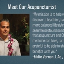 Acupuncture Fredericksburg - Acupuncture